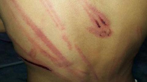 صور صادمة لطفل يتيم في السعودية يتعرض لضرب مبرح